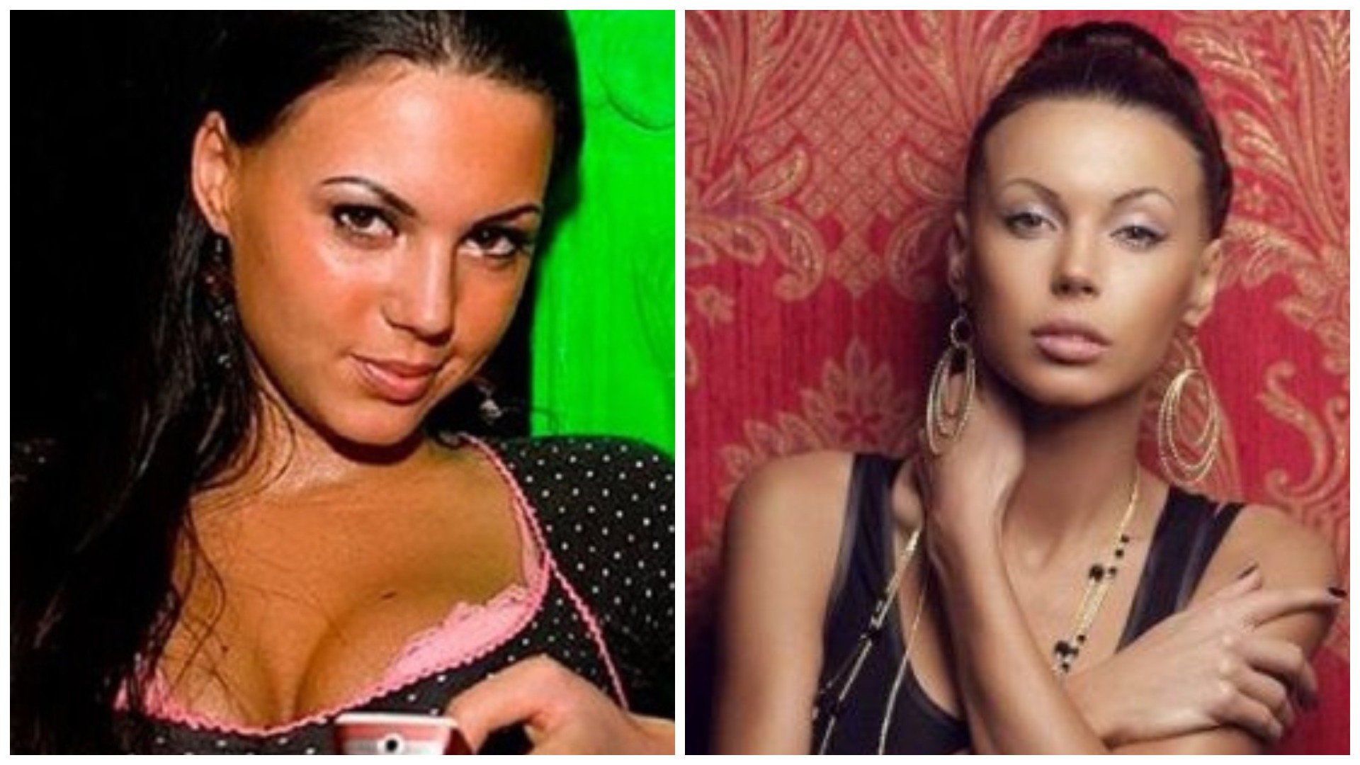 Оксана самойлова до и после пластических операций, фото и видео
